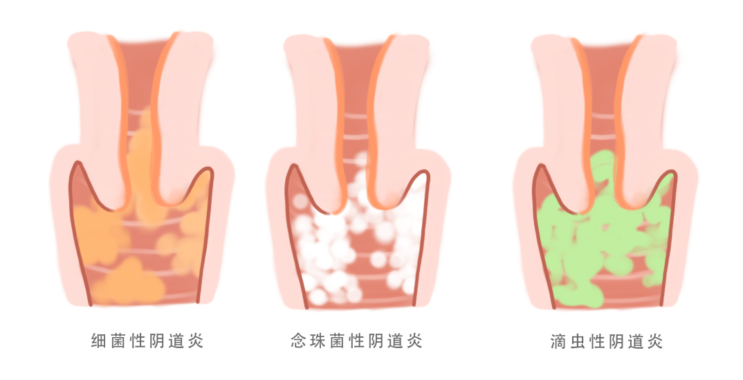 75dfa85f6a5ec4ea14b62f61887f931c.png